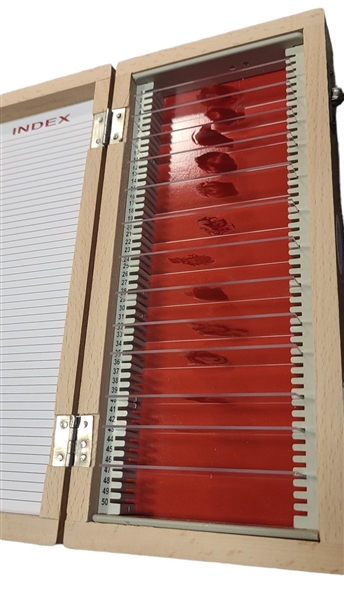 Dexter Cast Autographed Custom Blood Glass Slides Case (5 Sigs)(ACOA)