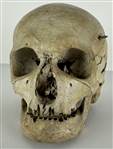 Incredible Actual Human Skull with Stone Arrowhead Lodged in Side! (Ex. Robert White Collection)